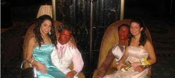 Tady to někdo přehnal se solárkem.