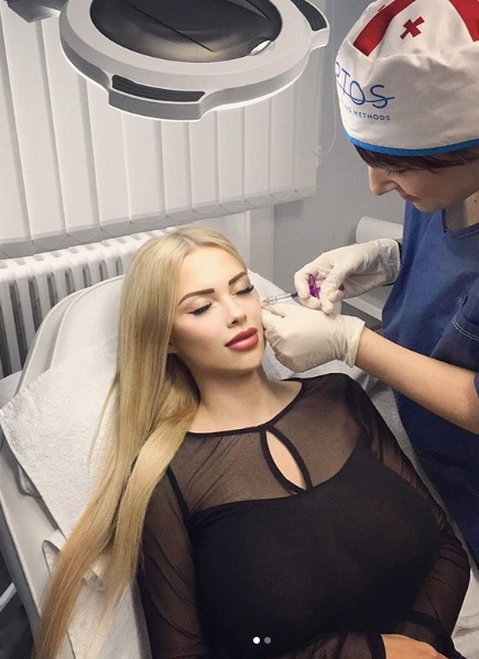 Do svých tváří si nechává aplikovat neinvazivní výplně.