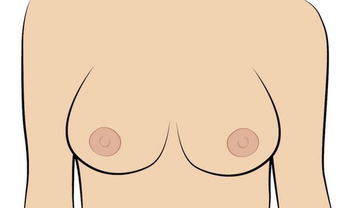 Ploché bradavky – to jsou takové bradavky, které nejsou nijak vystouplé. Dokonale opisují linii prsou.