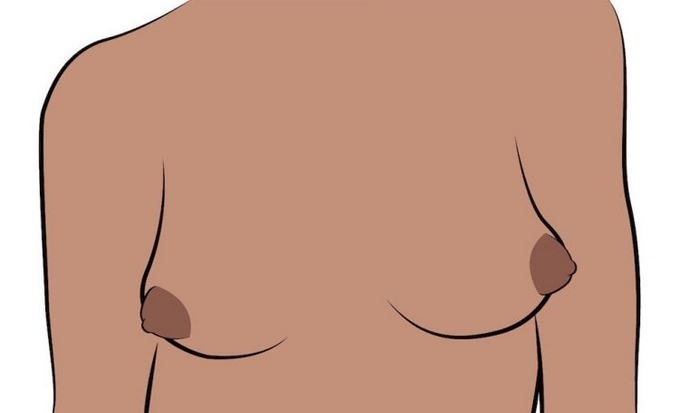 Vyčnívající bradavky – ty jsou vystouplé i s dvorci.