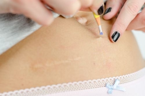 Mačká a vytrhává zarostlé chloupky.