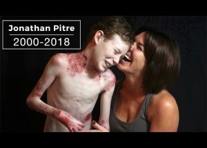 Poslední dny chlapce, který trpěl nevyléčitelnou nemocí. Pouze pro silné povahy