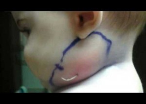 Přivezli jejich děťátko k doktorce s boulí na krku. Ta když na ni poté zatlačila, nevěřili vlastním očím!