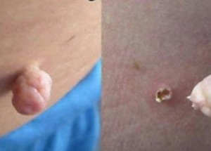 Má je skoro každý, ale nikdo pořádně neví, jak se jich zbavit. Tento trik ale dělá hotové zázraky!