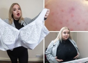 Tato žena trpí makromastií, v důsledku které jí neustále rostou prsa. „Je to jako prokletí,“ říká